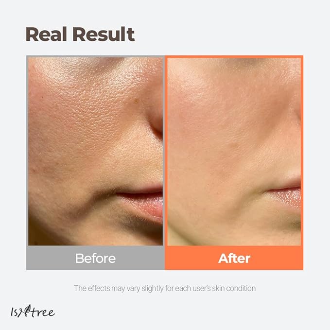 ISNTREE Green Tea Fresh Toner 200ml, 6.76 fl.oz | Korean Skincare | Toner for Oily Skin | Sebum Control | Hydrating and Refreshing