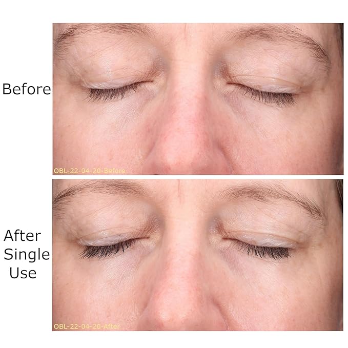 Hydrate & Soothe Beauty Collection, Activator with Awaken Facial & Vitamin B Concentrate, Face smoothing moisturizer, Skin Care Routine, For All Skin Type, Gift Bundle / Starter Kit